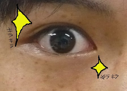 20101006-lasik.after.jpg